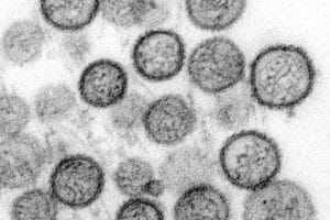 Kreuzfahrtschiff unter Quarantäne, Gesundheitswarnung, Hantavirus, Passagiere betroffen und Symptome sichtbar.